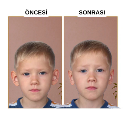 EARLAST™ Kulak Bandı (20 Adet 3-4 Ay Kullanım İçin Uygun)