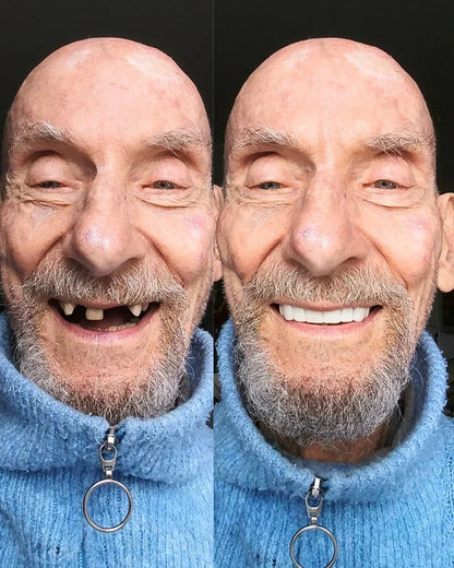 EARLAST LuxeSmile Biyouyumlu Yeni Nesil Takma Dişler