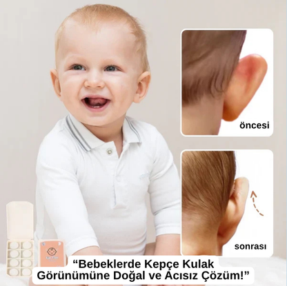 EARLAST™ Kulak Bandı (20 Adet 3-4 Ay Kullanım İçin Uygun)