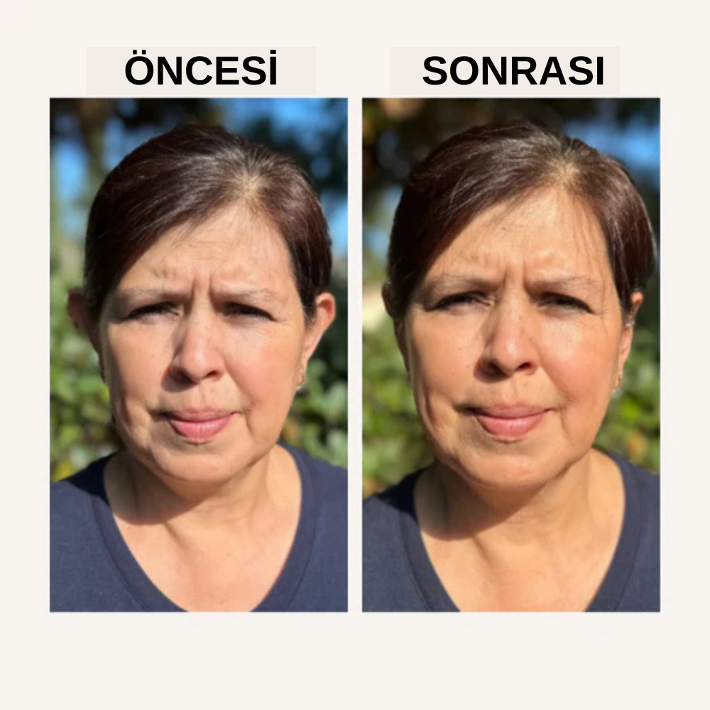 Earlast Kulak Düzeltici Piercing 2 Adet