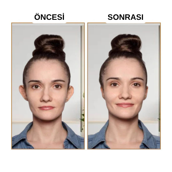 EARLAST™ Kulak Bandı (20 Adet 3-4 Ay Kullanım İçin Uygun)