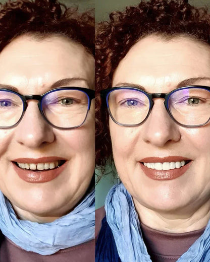 EARLAST LuxeSmile Biyouyumlu Yeni Nesil Takma Dişler