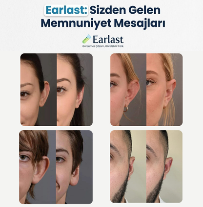 EarLast Clips ( 20 ADET )