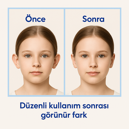 EARLAST™ Kulak Bandı (20 Adet 3-4 Ay Kullanım İçin Uygun)