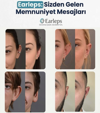 EarLeps Clips ( 20 ADET )